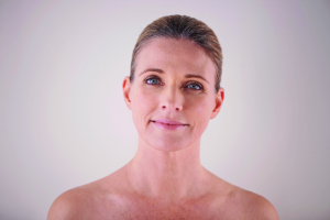 holistic microneedling beauty natural organic skin face treatment